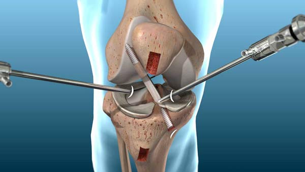 Why_Surgery